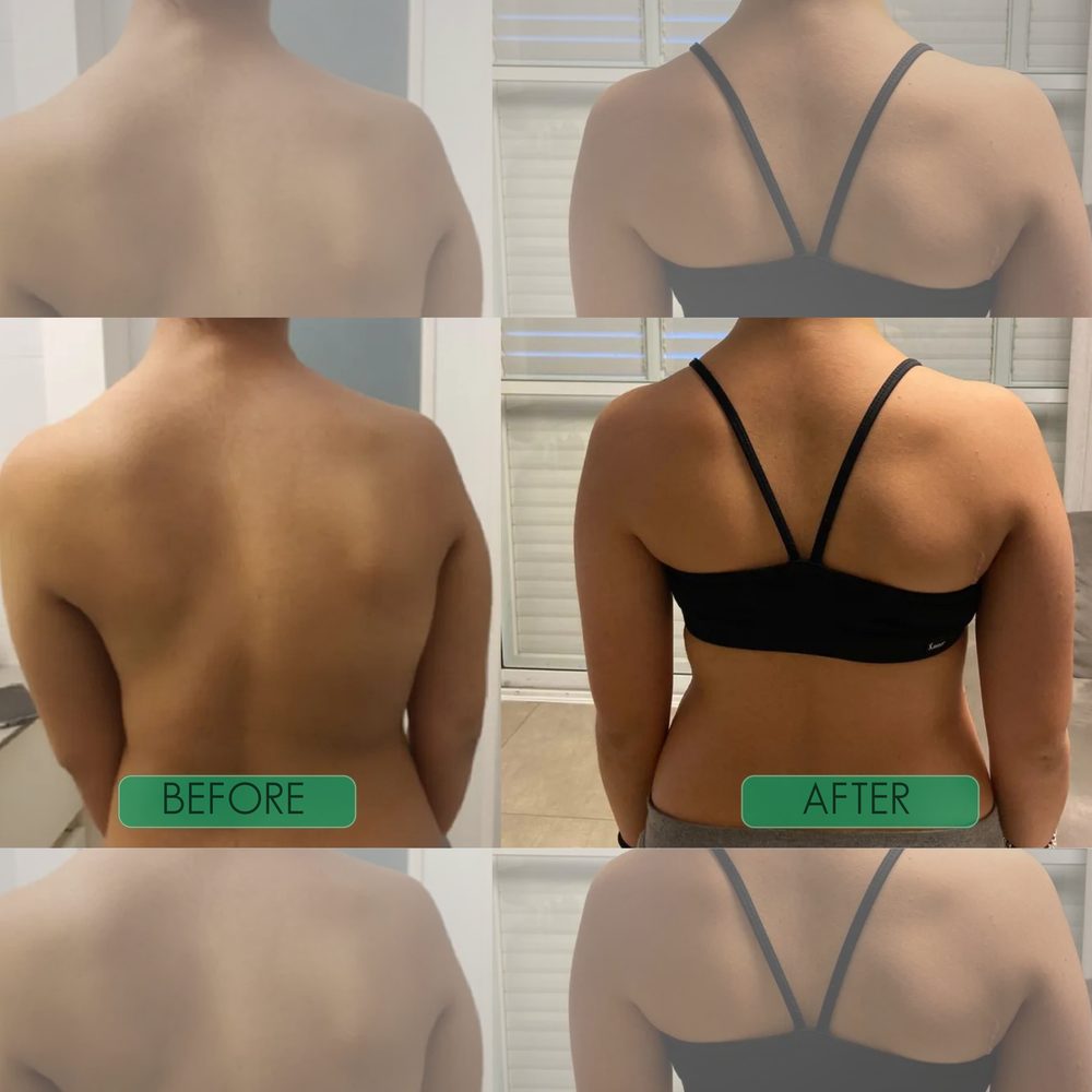 Before and after results