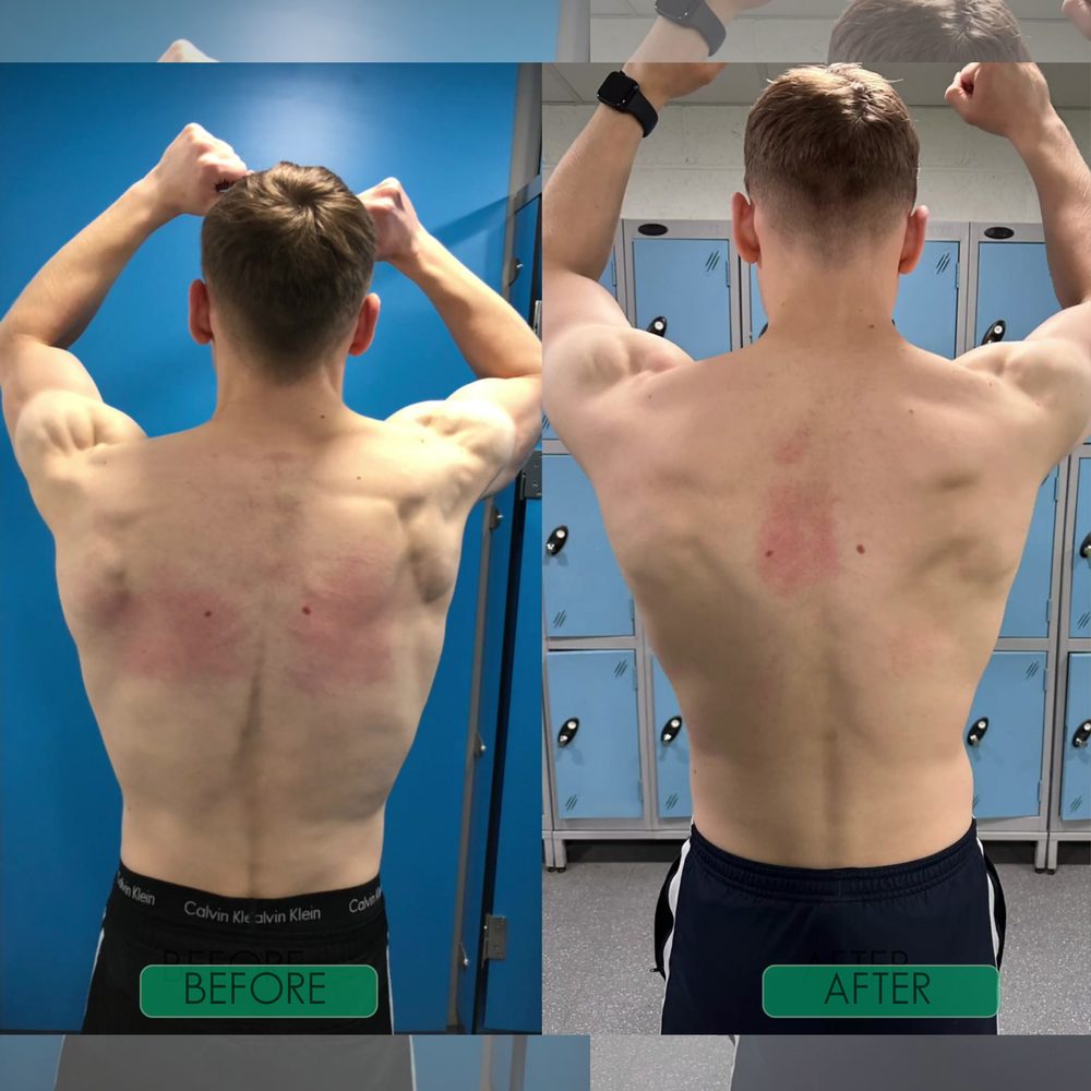 Before and after results